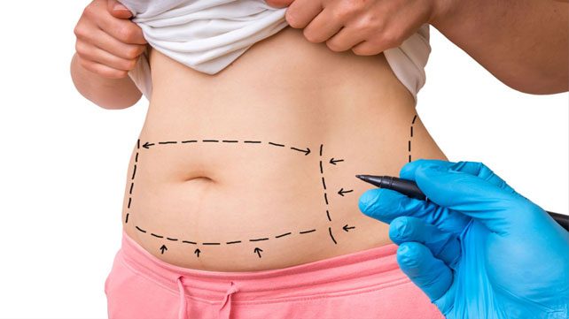 The Real Benefit of the Tummy Tuck and Mommy Makeover