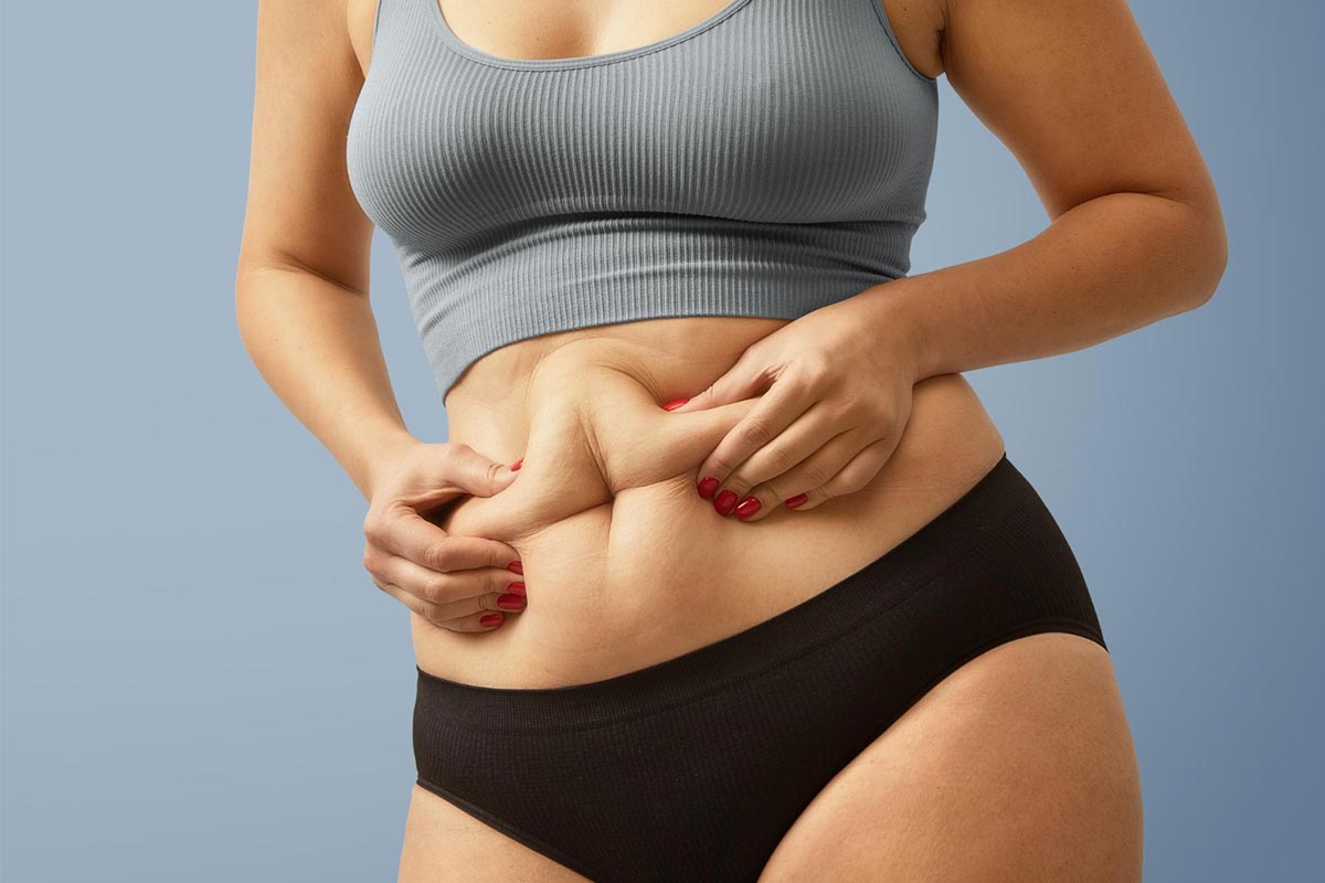 Can Liposuction Fat Come Back? What Patients Should Know
