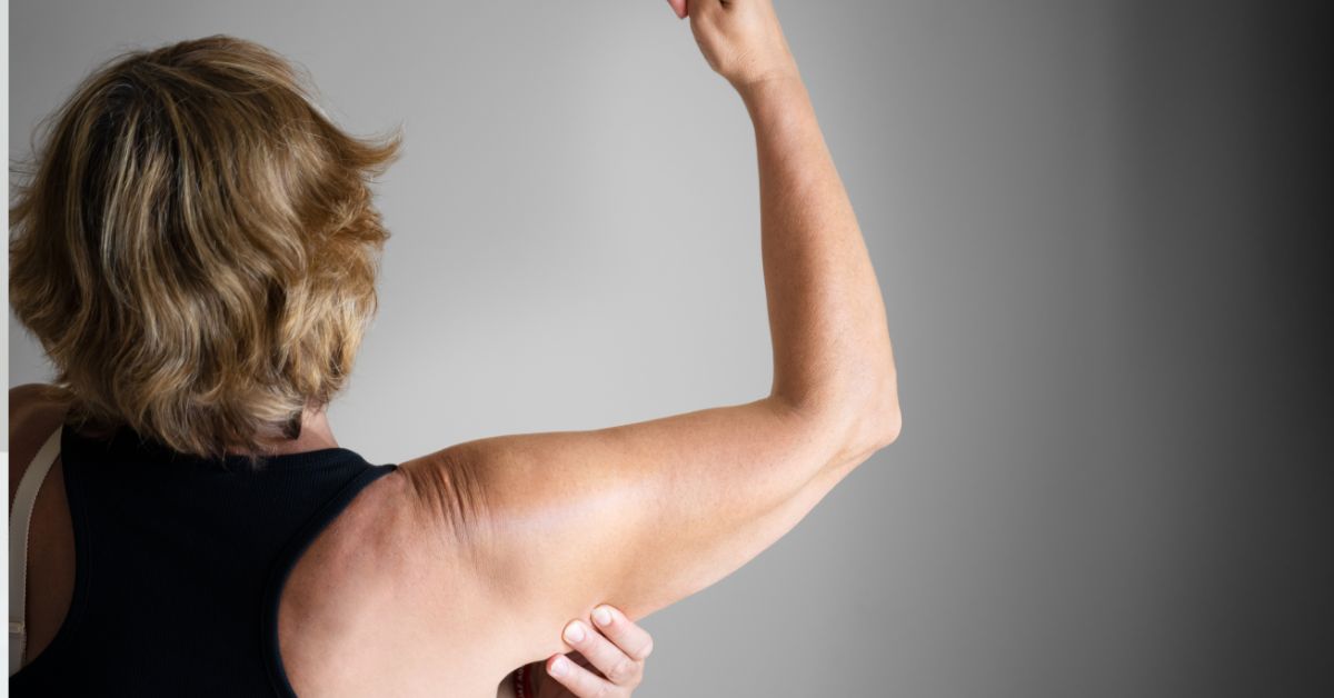 Arm Liposuction Recovery Timeline: What to Expect