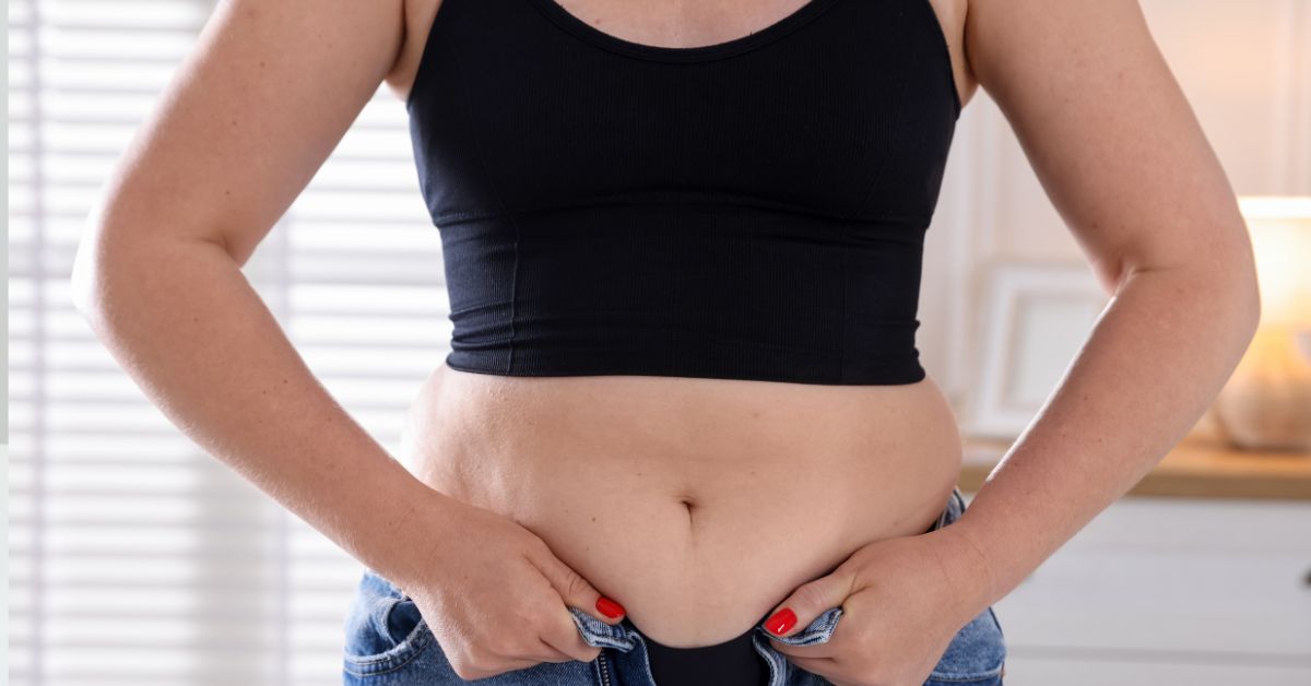 Is Tummy Liposuction a Permanent Fat Removal Solution?